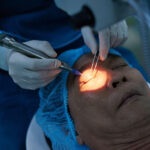 How to Choose the Best Laser Eye Surgeon in Sydney