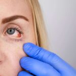 Recognizing the Early Signs of Glaucoma: Key Symptoms to Watch For